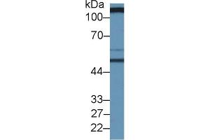 Image no. 2 for Solute Carrier Family 3 (Activators of Dibasic and Neutral Amino Acid Transport), Member 2 (SLC3A2) ELISA Kit (ABIN6720502)