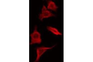 Image no. 3 for anti-Secretoglobin, Family 2A, Member 1 (SCGB2A1) antibody (ABIN6263088)