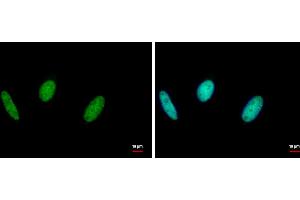 Image no. 1 for anti-E3 ubiquitin-protein ligase RAD18 (RAD18) (Center) antibody (ABIN2856942)