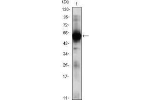 Image no. 1 for anti-Recombination Activating Gene 2 (RAG2) (AA 350-527) antibody (ABIN969379)