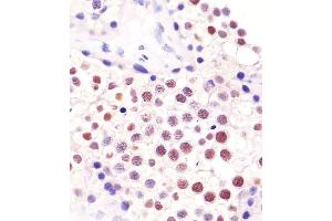 Image no. 5 for anti-ELAV (Embryonic Lethal, Abnormal Vision, Drosophila)-Like 1 (Hu Antigen R) (ELAVL1) antibody (ABIN652911)