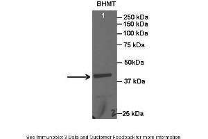 Image no. 4 for anti-Betaine--Homocysteine S-Methyltransferase (BHMT) (C-Term) antibody (ABIN2776836)