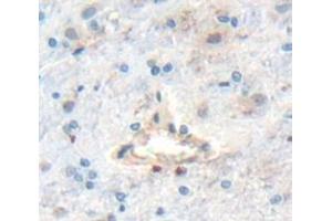 Image no. 2 for anti-Disabled Homolog 1 (Drosophila) (DAB1) (AA 42-168) antibody (ABIN1867505)
