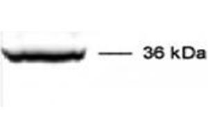 Image no. 1 for anti-Cathepsin L1 (CTSL1) (Mature) antibody (ABIN1106826)