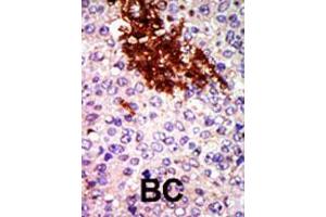 Image no. 1 for anti-RIO Kinase 1 (RIOK1) (AA 126-156), (N-Term) antibody (ABIN391301)