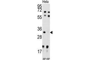 Image no. 2 for anti-Uridine-Cytidine Kinase 2 (UCK2) (N-Term) antibody (ABIN359376)