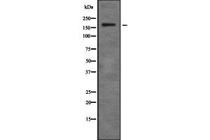 Image no. 1 for anti-Zinc Finger, MYM-Type 4 (ZMYM4) (Internal Region) antibody (ABIN6266119)