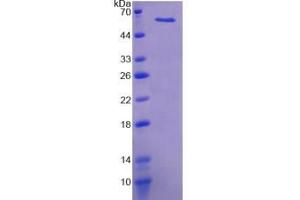 Image no. 1 for Kininogen (High Molecular Weight) (AA 268-540) protein (His tag,SUMO Tag) (ABIN1878781)