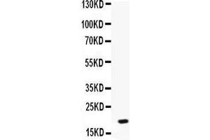 Image no. 2 for anti-Pro-Platelet Basic Protein (Chemokine (C-X-C Motif) Ligand 7) (PPBP) (AA 55-128) antibody (ABIN3044533)