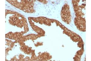 Image no. 1 for anti-Ret Proto-Oncogene (RET) (AA 702-848) antibody (ABIN6940507)