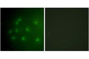 Image no. 2 for anti-Retinoblastoma Protein (Rb Protein) (AA 601-650), (pThr826) antibody (ABIN1531625)