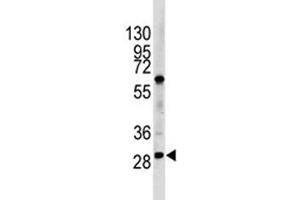 Image no. 6 for anti-Lin-28 Homolog B (LIN28B) (AA 1-30) antibody (ABIN3031628)