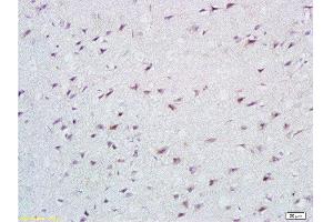 Formalin-fixed and paraffin embedded rat brain tissue labeled with Anti-Cathepsin B Polyclonal Antibody, Unconjugated at 1:200 followed by conjugation to the secondary antibody, (SP-0023), and DAB staining
