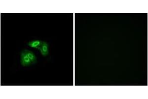 Image no. 1 for anti-Vomeronasal 1 Receptor 5 (VN1R5) (AA 44-93) antibody (ABIN1536020)