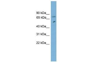 Image no. 1 for anti-Dynein, Cytoplasmic 1, Intermediate Chain 2 (DYNC1I2) (N-Term) antibody (ABIN633070)