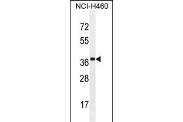 ZC3H15 antibody  (C-Term)
