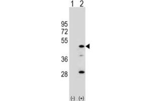 Image no. 1 for anti-Arylacetamide Deacetylase (Esterase) (AADAC) antibody (ABIN3002812)