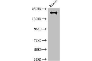 Integrin beta 4 antibody  (AA 1401-1533)