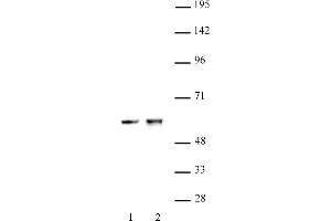 anti-Cyclin-Dependent Kinase 8 (CDK8) (C-Term) antibody