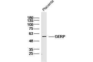 Image no. 2 for anti-Tripartite Motif Containing 8 (TRIM8) antibody (ABIN1387072)