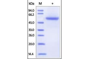 Human Carbonic Anhydrase IX (38-414), His Tag on SDS-PAGE under reducing (R) condition.