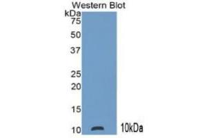 Image no. 2 for S100 Calcium Binding Protein P (S100P) ELISA Kit (ABIN6720579)