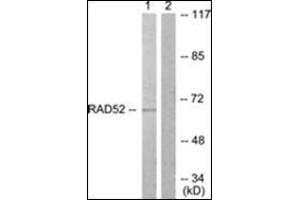 DPYSL2 antibody  (C-Term)