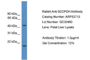 Image no. 2 for anti-Saccharopine Dehydrogenase (SCCPDH) (Middle Region) antibody (ABIN2785529)