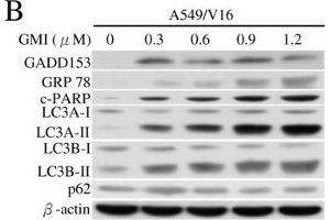 Image no. 11 for anti-Sequestosome 1 (SQSTM1) (Internal Region) antibody (ABIN2854836)