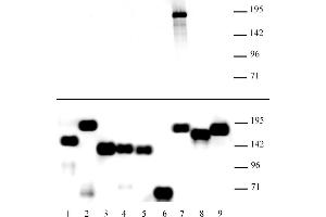 Image no. 1 for anti-Lysine (K)-Specific Demethylase 5A (KDM5A) antibody (ABIN6972256)