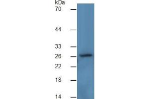 Image no. 2 for Carbonic Anhydrase II (CA2) ELISA Kit (ABIN6574206)