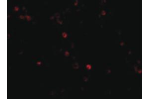 Image no. 3 for anti-Interferon Induced with Helicase C Domain 1 (IFIH1) (C-Term) antibody (ABIN6655946)