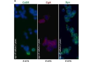 Expression of CaSR by P-STS cells.