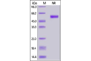 Image no. 2 for Tumor Necrosis Factor (Ligand) Superfamily, Member 13b (TNFSF13B) (AA 140-285) (Active) protein (His tag,DYKDDDDK Tag) (ABIN7013542)
