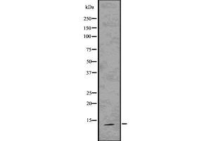 Image no. 2 for anti-S100 Calcium Binding Protein A9 (S100A9) antibody (ABIN6264908)