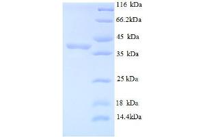 Image no. 1 for Mindbomb E3 Ubiquitin Protein Ligase 1 (MIB1) (AA 5-332), (partial) protein (His tag) (ABIN1046954)