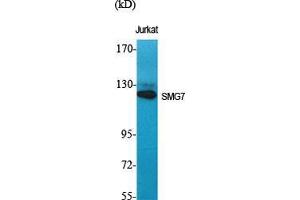 Image no. 2 for anti-Smg-7 Homolog, Nonsense Mediated mRNA Decay Factor (SMG7) (Internal Region) antibody (ABIN3187000)