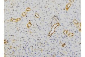 Image no. 1 for anti-RAB23, Member RAS Oncogene Family (RAB23) (C-Term) antibody (ABIN6264565)