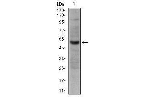 Image no. 1 for anti-Tumor Necrosis Factor Receptor Superfamily, Member 8 (TNFRSF8) antibody (ABIN1106248)