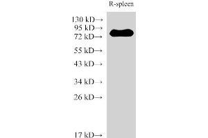 IL-6 Receptor antibody