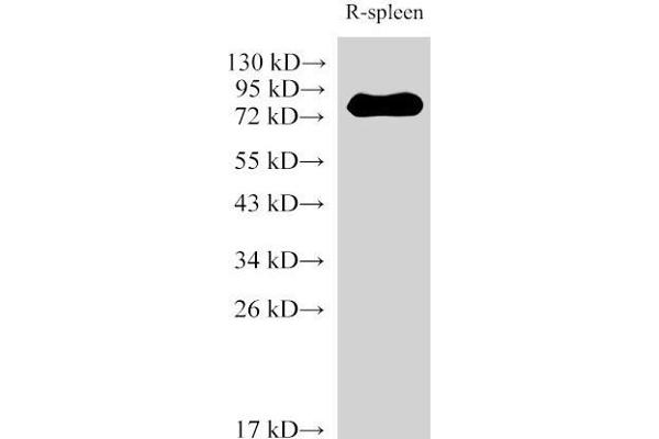 IL-6 Receptor antibody