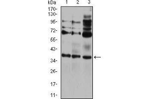 Image no. 2 for anti-Cell Death-Inducing DFFA-Like Effector C (CIDEC) (AA 53-141) antibody (ABIN5542500)
