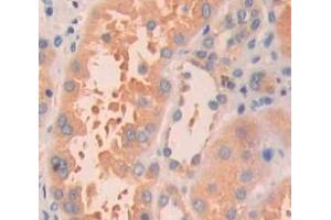 Image no. 3 for anti-HRas proto-oncogene, GTPase (HRAS) (AA 82-176) antibody (ABIN1980538)