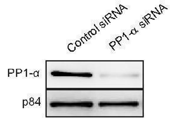 anti-Protein Phosphatase 1, Catalytic Subunit, alpha Isoform (PPP1CA) (Center) antibody