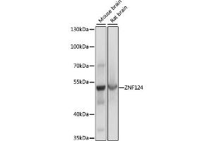 Image no. 1 for anti-Zinc Finger Protein 124 (ZNF124) antibody (ABIN6568575)