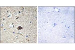 Image no. 2 for anti-Tumor Necrosis Factor (Ligand) Superfamily, Member 12 (TNFSF12) (AA 41-90) antibody (ABIN1533507)