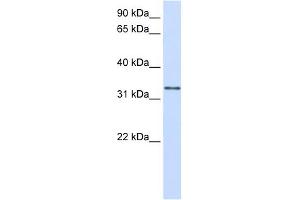 Image no. 1 for anti-Trans-2,3-Enoyl-CoA Reductase (TECR) (C-Term) antibody (ABIN635646)
