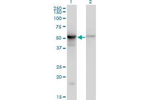 Image no. 4 for anti-Tubulin, beta 2A (TUBB2A) (AA 1-445) antibody (ABIN521144)