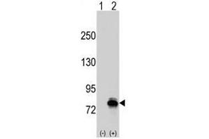 Image no. 1 for anti-K-Cadherin (CDH6) (N-Term) antibody (ABIN356889)