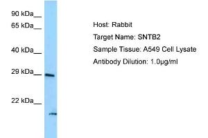 Image no. 1 for anti-Syntrophin, beta 2 (Dystrophin-Associated Protein A1, 59kDa, Basic Component 2) (SNTB2) (N-Term) antibody (ABIN2789293)